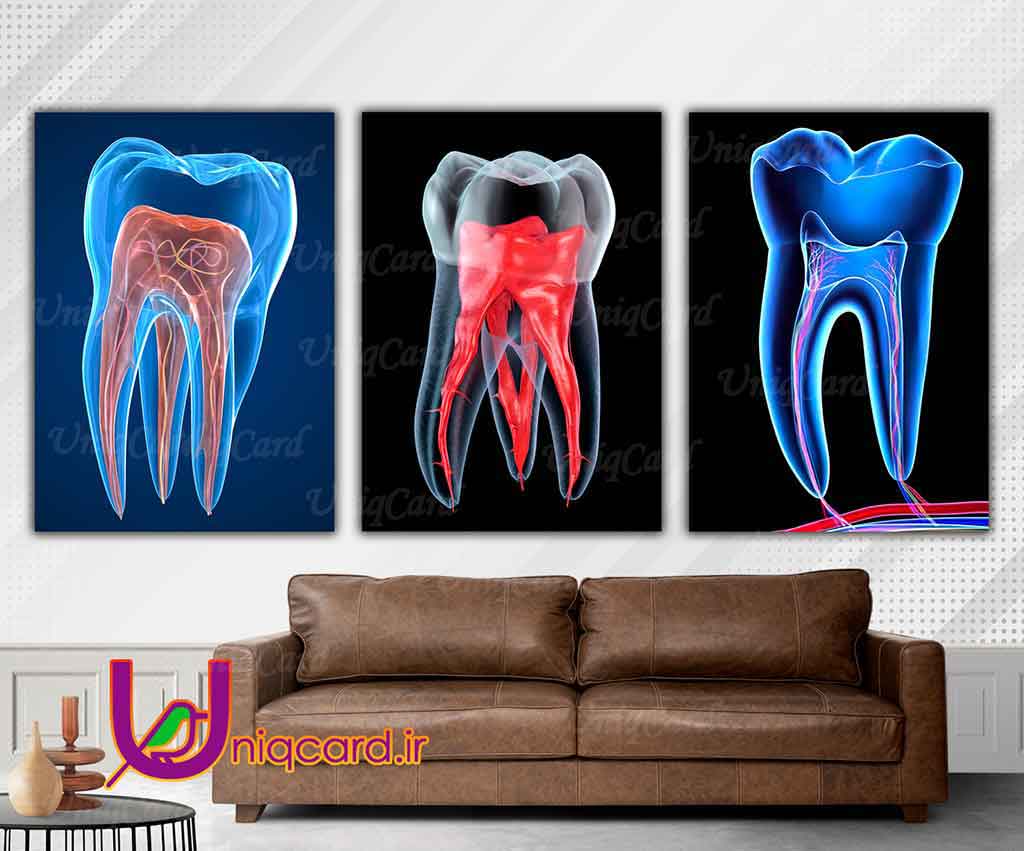 فایل PSD لایه باز پوستردیواری مطب و کلینیک دندانپزشکی با طرح تابلو دکوراتیو سه دندان خراب